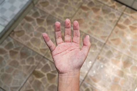 maceration